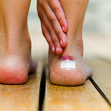 Blasen an den Füßen